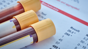 servicios veterinarios analítica propia en Orihuela y Bigastro