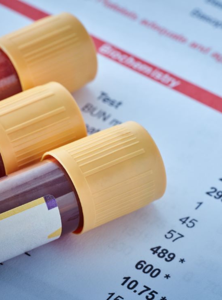 Servicios veterinarios de analítica y laboratorio propio en Orihuela y Bigastro.